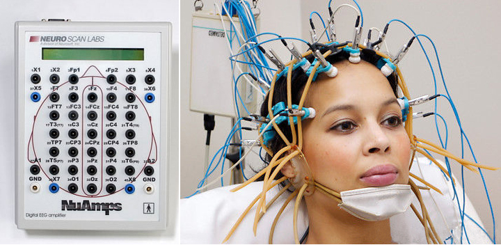 electroencephalography