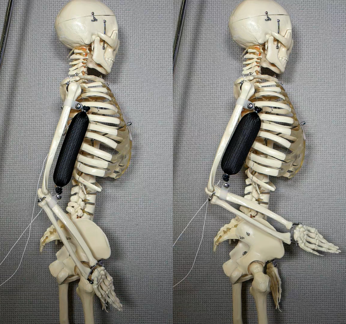 Artificial Muscle Lift Skeleton's Arm